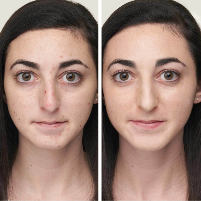 Течен коректор за възпаления и несъвършенства Zap&Hide® - Jane Iredale - Image 3