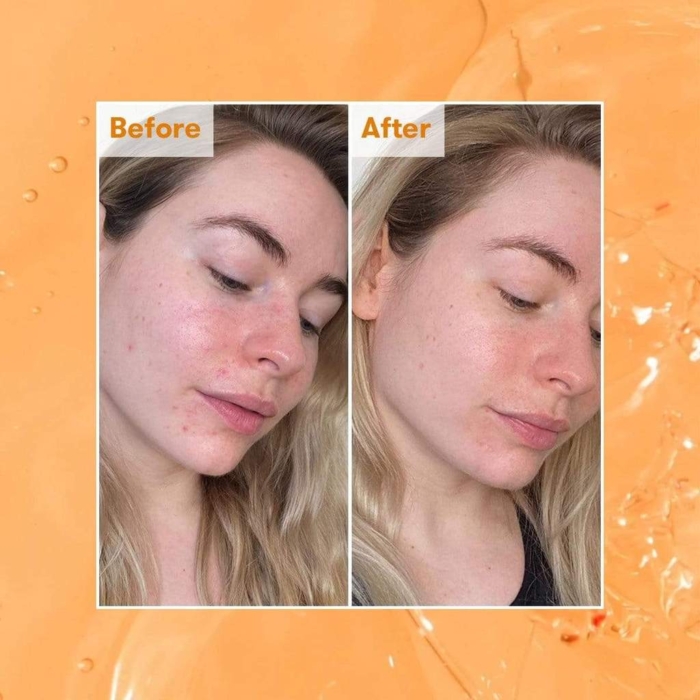 Radiance Glow - AHA тоник за лице - REN - Image 3