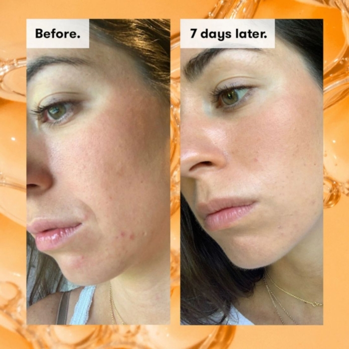 Radiance Glow - AHA тоник за лице - REN - Image 2