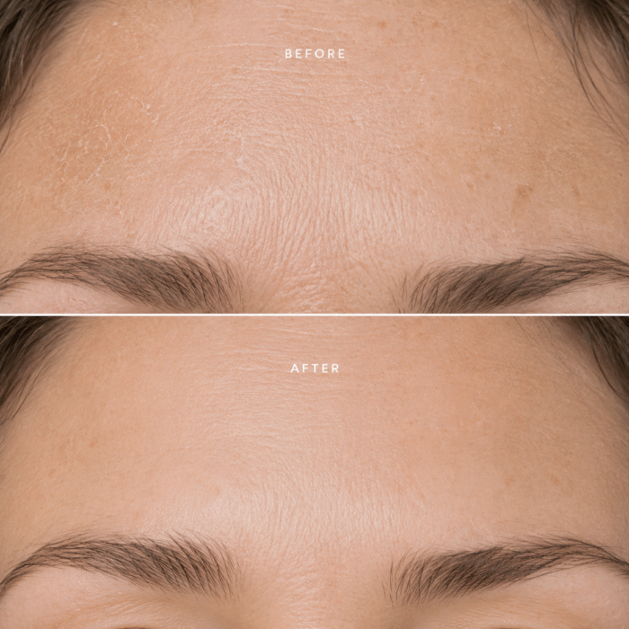 Kрем за лице с растителни стволови клетки STEM CELL Аnti-age- Arvena - Image 4
