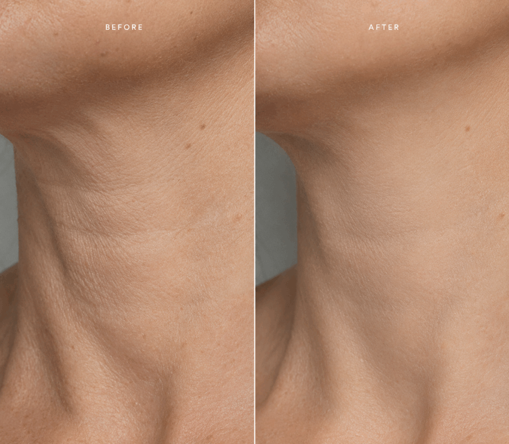 arvena-stem-cell