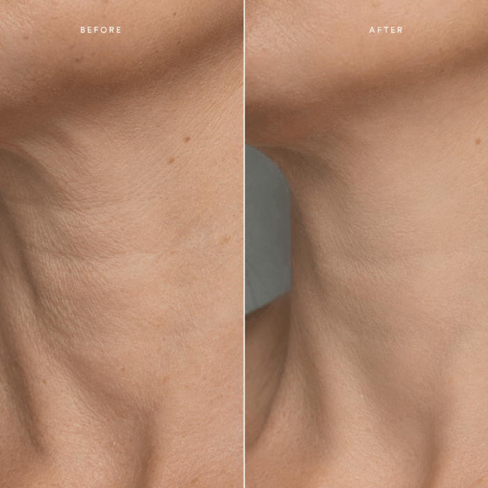 arvena-stem-cell