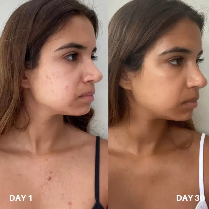 Clinisoothe+ Skin Purifier - Хипохлорна киселина - Image 3