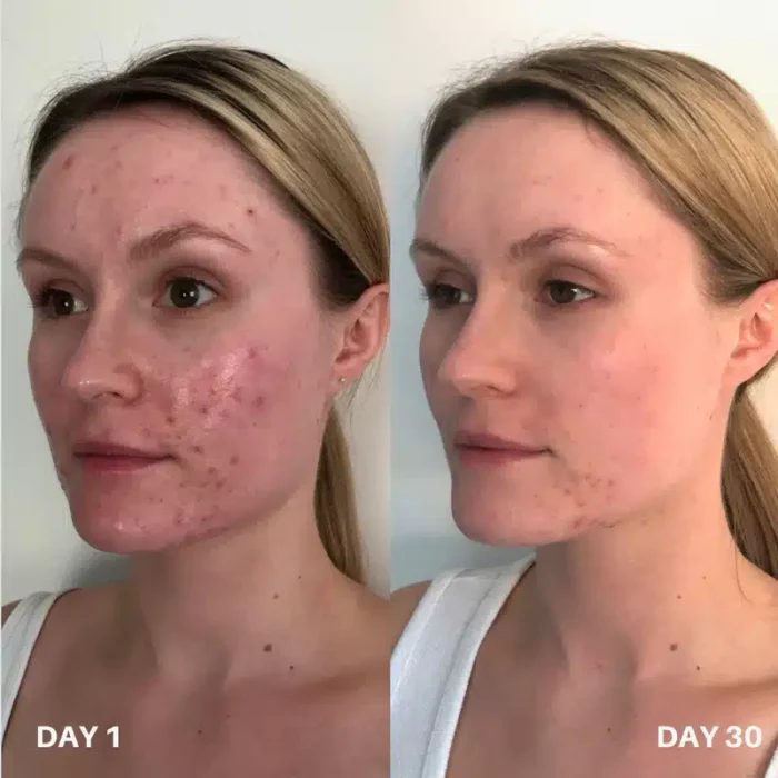 Clinisoothe+ Skin Purifier - Хипохлорна киселина - Image 2