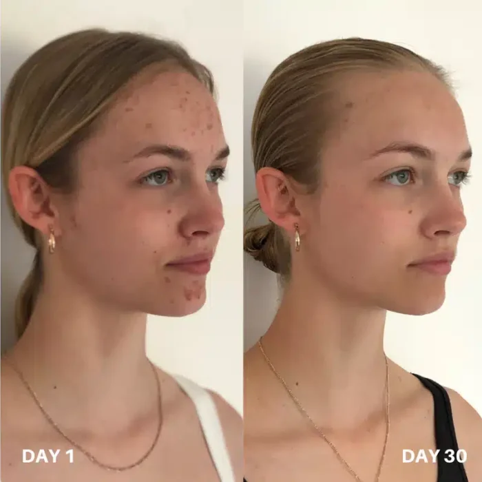 Clinisoothe+ Skin Purifier - Хипохлорна киселина - Image 5