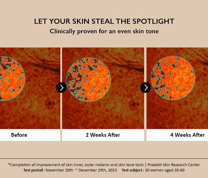 Серум против пигментни петна - концентрат 4% ТХА - Haruharu Wonder