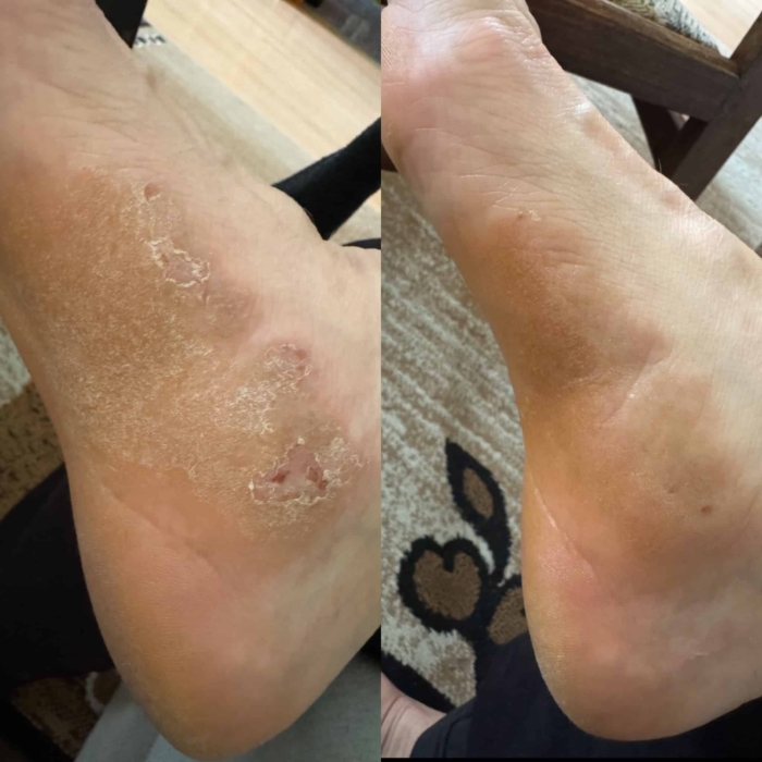 ATO крем за лице и тяло при суха кожа с атопичност - Weedness - Image 2