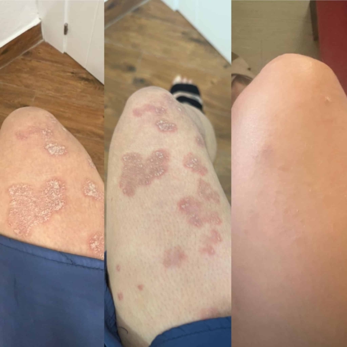 ATO крем за лице и тяло при суха кожа с атопичност - Weedness - Image 3