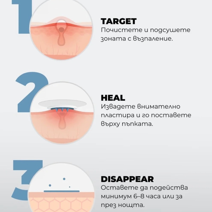 NeedleX+ Пластир с активни микроигли срещу пъпки - Al+ CosmeticsNeedleX+ Пластир с активни микроигли срещу пъпки - Al+ Cosmetics