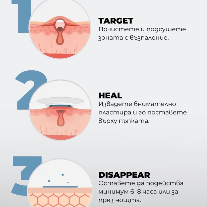 Хидроколоиден пластир срещу пъпки Spotless+ - Al+ Cosmetics