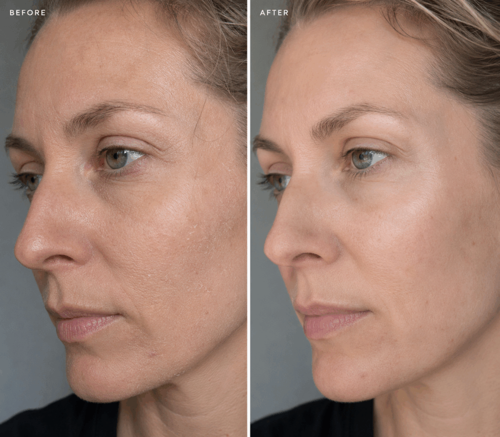 ceramide-serum