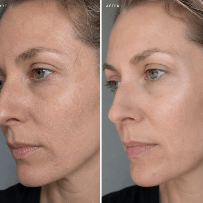 ceramide-serum