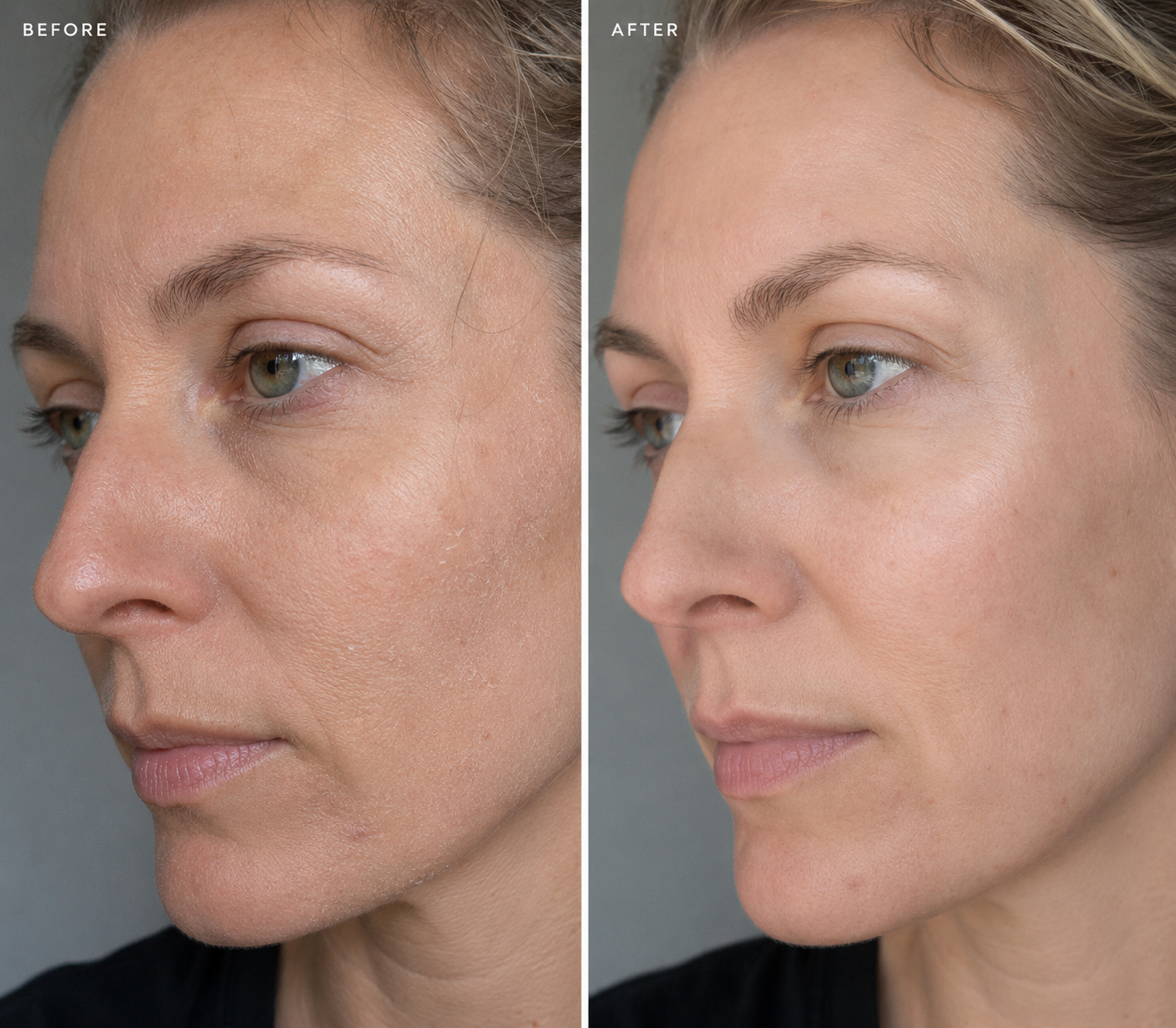 ceramide-serum